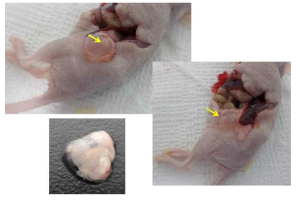 췌장암 세포주 이식 후 5주 차 종양 크기 확인 및 종양제거 외과 수술 모델 확립
