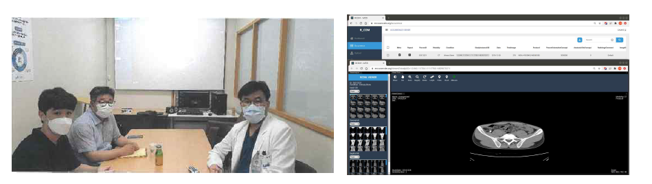 중앙대학교병원의 박성빈 교수 연구팀(요로결석 인공지능)의 R-CDM 기반 연구 (2020.07.21.)