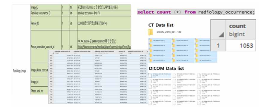 의료영상 CDM 확장모델 설계서 일부 및 시범 변환 결과