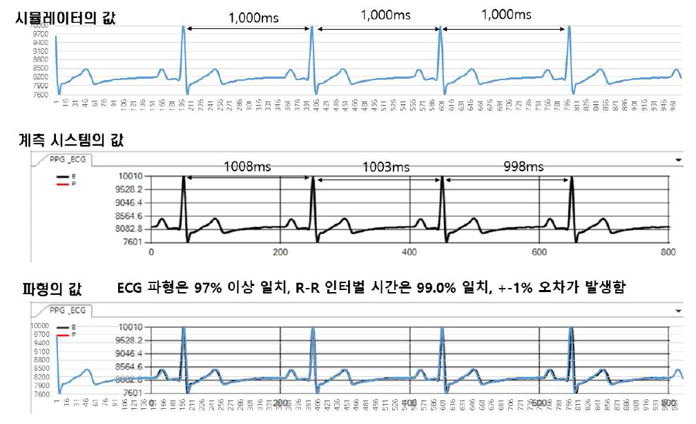1000ms R-R 간격(60bpm)에서의 ECG 파형 매칭 결과
