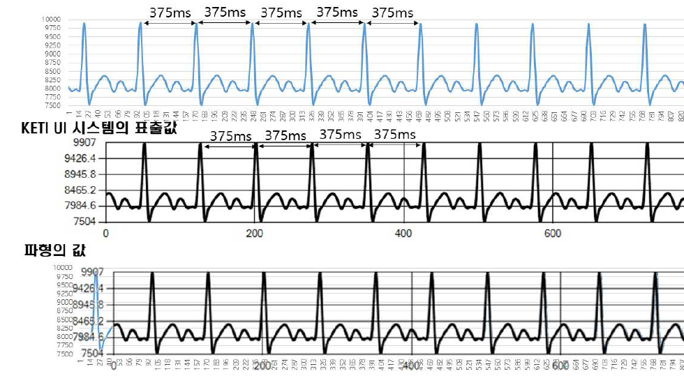 R-R 간격(200bpm)에서의 ECG 파형 매칭 결과