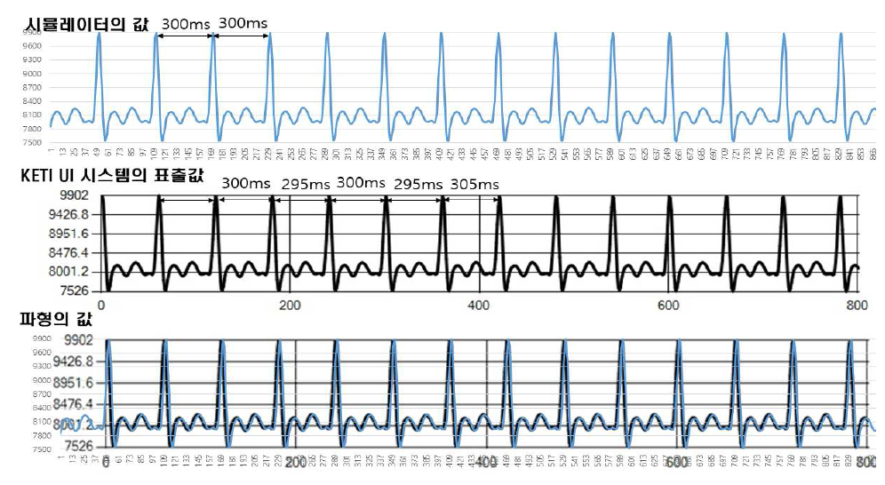 300ms R-R 간격(200bpm)에서의 ECG 파형 매칭 결과