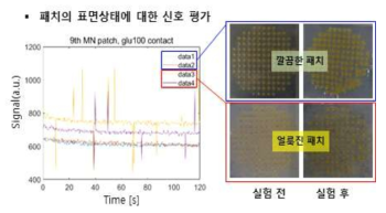 마이크로니들 패치의 표면 상태에 대한 신호 평가