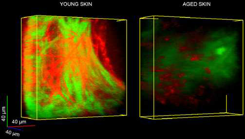 (수식) 피부조직 내 콜라겐 엘라스틴 섬유 Multi photon microscopy 이미지5)