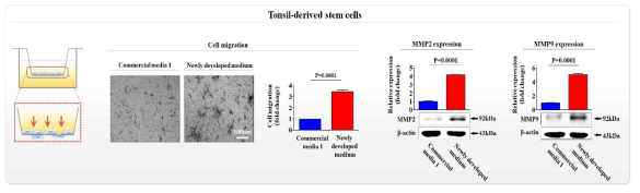 개발한 배양액이 기존 제품과 비교해 편도 유래 줄기세포의 이동에 미치는 영향 평가>