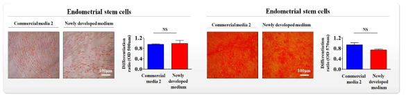 개발한 배양액이 기존 제품과 비교해 자궁 줄기세포의 분화 능력에 미치는 영향 평가>
