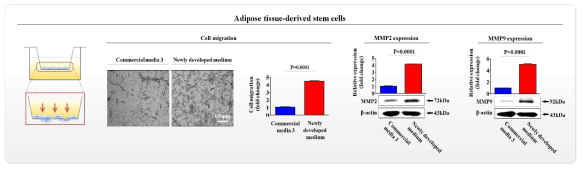 개발한 배양액이 기존 제품과 비교해 지방 유래 줄기세포의 이동에 미치는 영향 평가>