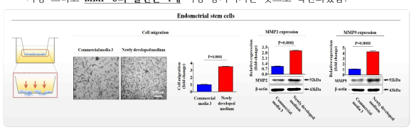 개발한 배양액이 기존 제품과 비교해 자궁 유래 줄기세포의 이동에 미치는 영향 평가>