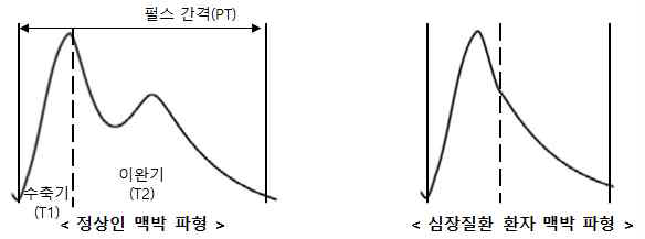 맥박 파형 분석을 통한 건강체크