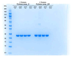 proteolytic activity screening의 SDS-PAGE 결과