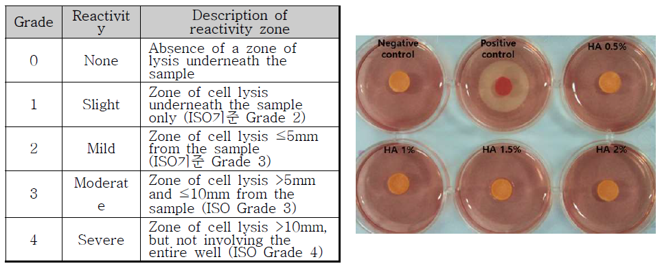 세포독성 평가기준 및 히알루론산 세포독성 시험결과 (Agar overlay)