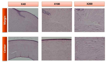 비글견 ex vivo 자가각막 이식모델에서 수술 7일 후 조직학적 평가 실시 (Margin: 자가각막편을 봉합한 부위, Center: 조직편의 중심부)(염색: H&E 염색)
