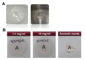 농도별로 제작된 콜라겐 쉴드 및 양막의 투명도를 나타낸 사진. A. 콜라겐 쉴드의 수화 전 및 수화 후 사진. B. 농도별 콜라겐 쉴드 및 양막의 투명도를 나타낸 사진으로 모든 콜라겐 쉴드 및 양막에서 투명함을 나타내었음