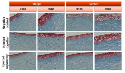 1M NaOH로 ex vivo alkali burn을 형성한 후 7일차의 조직사진. Negative control: 1M NaOH만 적용한 군, injected together: solution 1과 2를 함께 적용한 군, injected separately: solution 1과 2를 따로 적용한 군(염색: Masson’s trichrome)