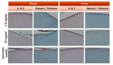 1M NaOH로 ex vivo alkali burn을 형성한 후 2일차의 조직사진. 7.5 mg/ml: 7.5 mg/ml 콜라겐 쉴드를 fibrin glue로 부착한 군, 10 mg/ml: 10 mg/ml 콜라겐 쉴드를 fibrin glue로 부착한 군, Amniotic memb.: 양막을 fibrin glue로 적용한 군