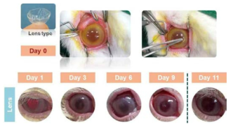 토끼에서 렌즈 타입 콜라겐 쉴드의 적용 사진