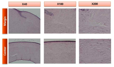 비글견 ex vivo 자가각막 이식모델에서 수술 7일 후 조직학적 평가 실시 (Margin: 자가각막편을 봉합한 부위, center: 조직편의 중심부)(염색: H&E 염색)