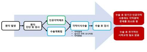 기술 개발 완료 시 각막이식수술 과정