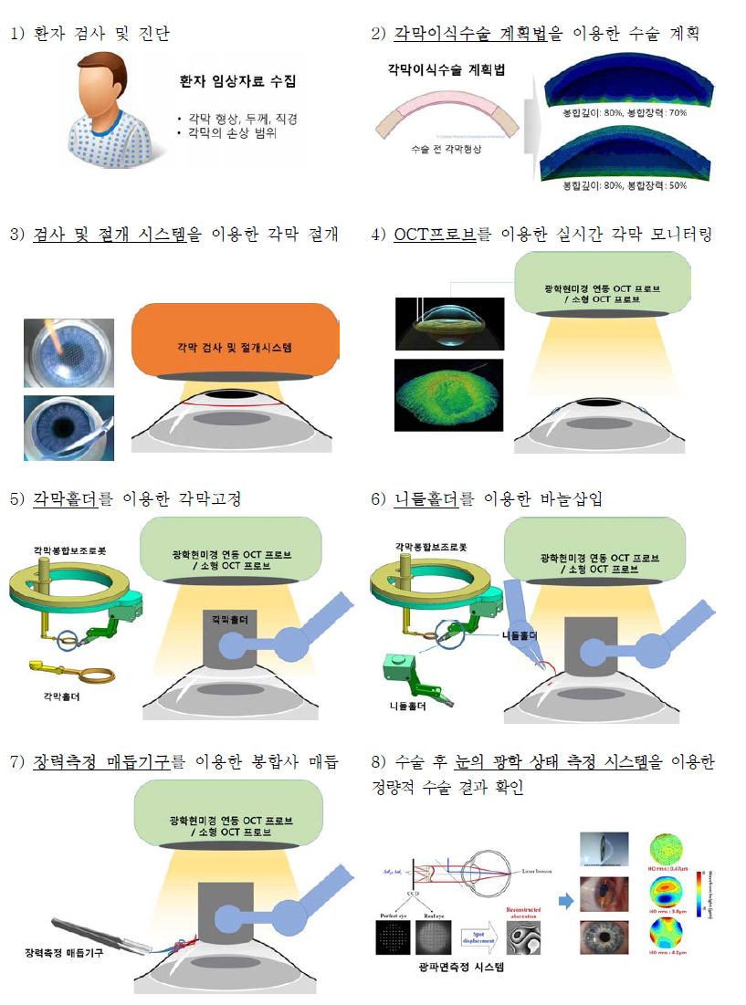 각막봉합보조로봇과 각막 검사 및 절개 시스템을 이용한 각막이식수술 과정