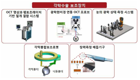 각막수술 보조장치의 종류