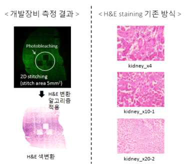 개발장비 측정 1차 결과 및 H&E staining 기존 방식