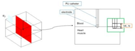 전극 카테터 및 심근 조직 해석 모델링