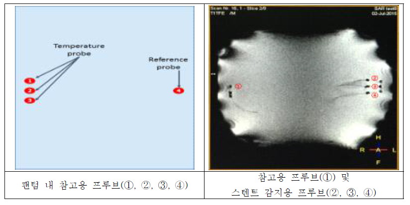 3T MRI Probe setting