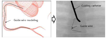 개발된 알고리즘을 이용하여 생성된 가이드와이어 모델(좌) 및 X-선 영상에서의 렌더링(우)