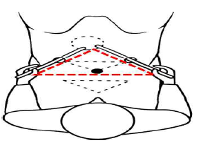 Triangulation 훈련