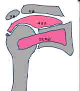 회전근개 파열의 발생부위로 근상근 힘줄의 부착부위에서 끊어짐