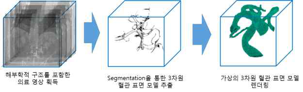 Segmentation을 통한 3차원 모델 추출