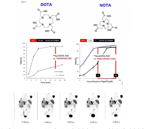 DOTA, DOTA-TOC 및 NOTA의 화학적 구조, 표지수율 및 영상평가