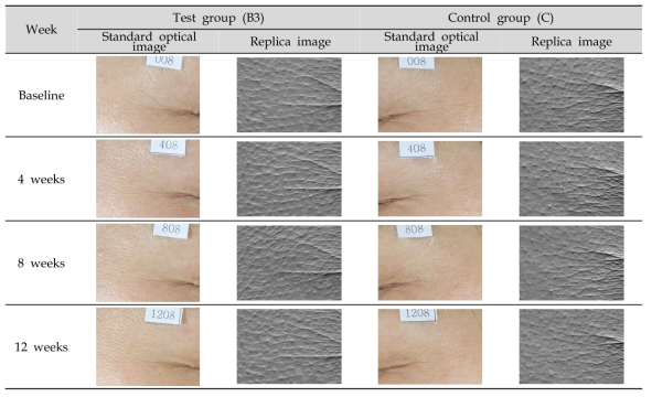Changes of skin wrinkle following 12 consecutive weeks application of the test products (Ref. Subject No. 08)