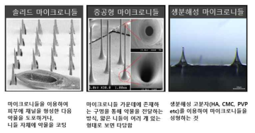 마이크로니들 종류별 특징