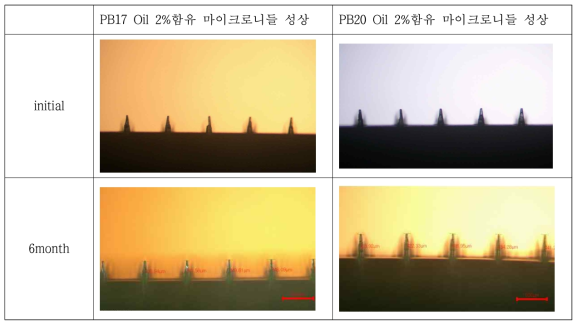 상온 보관된 마이크로니들 현미경 사진 (평균 길이 300um)