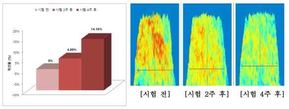 피부결 개선율 & 피부결 개선 이미지