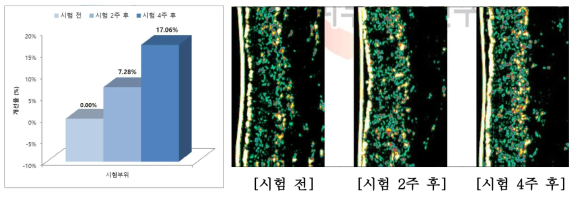 피부 치밀도 개선율, 피부치밀도 개선 이미지