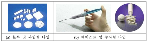 다양한 형태의 골이식재