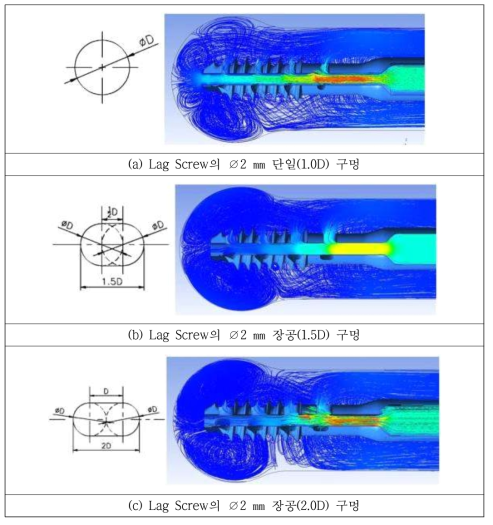 Flow Lag Screw의 구멍의 크기에 따른 유동해석 결과