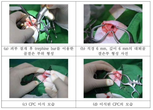 InjectBone 적용을 위한 양측 대퇴골 골 결손의 수술적 형성