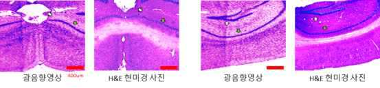 Mouse brain의 psudo-colored 광음향 영상과 H&E 현미경 사진