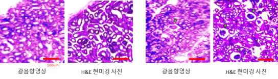 Mouse kidney의 psudo-colored 광음향 영상과 H&E 현미경 사진