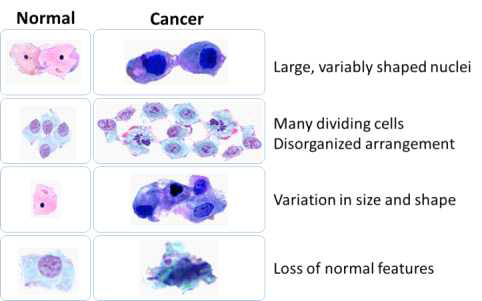 정상세포와 암세포의 구조적 차이