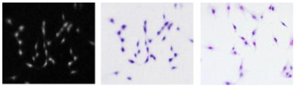 Osteoblast cell의 광음향 영상 (왼쪽), Psudo-color 광음향 영상(가운데), H&E 염색 현미경 영상(오른쪽)