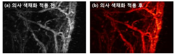 광음향 영상의 의사 색채화 전후 영상 비교