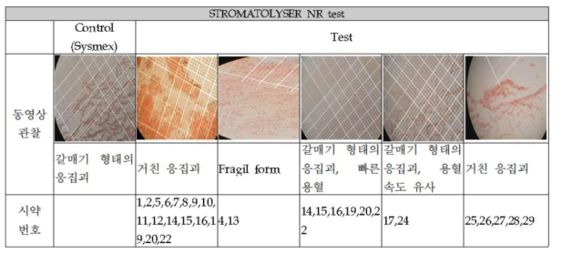 기준시약과 비교시약의 동영상 관찰 비교 결과 예시