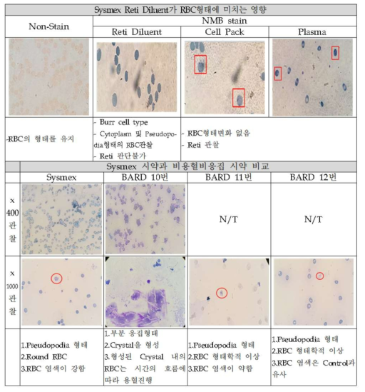 RET 희석시약이 RBC형태에 미치는 영향 분석 예시