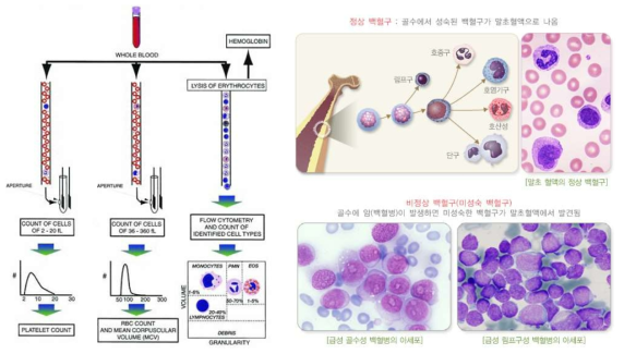 자동혈구분석 원리 및 도말표본을 이용한 현미경 혈구 검사 예시