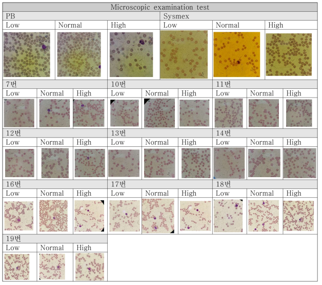 기준시약과 BACS 시약의 Microscopic examination test