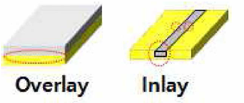 Overlay , Inlay 접점계면 SEM 측정 부위 모식